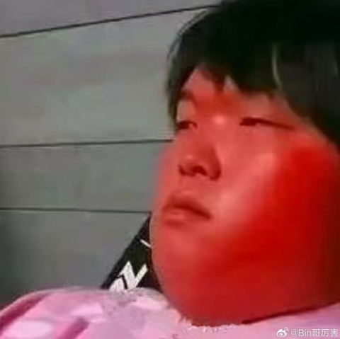 BLG上单选手Bin深夜分享自己的红温表情包